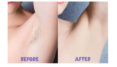 Beauty Painless Hair Removal